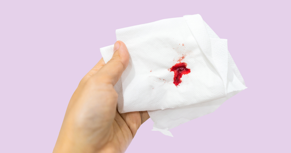 Causes of bleeding during and after sex Flo